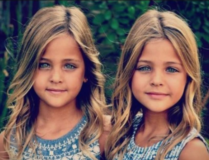 Пред 9 години беа прогласени за најубави близначки на светот- вака изгледаат денес