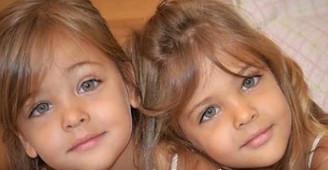 Беа прогласени за најубави близначки на светот во 2010 година, а погледнете како изгледаат денес